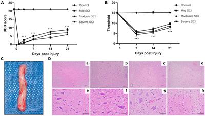 Biomarkers for predicting the severity of spinal cord injury by proteomic analysis